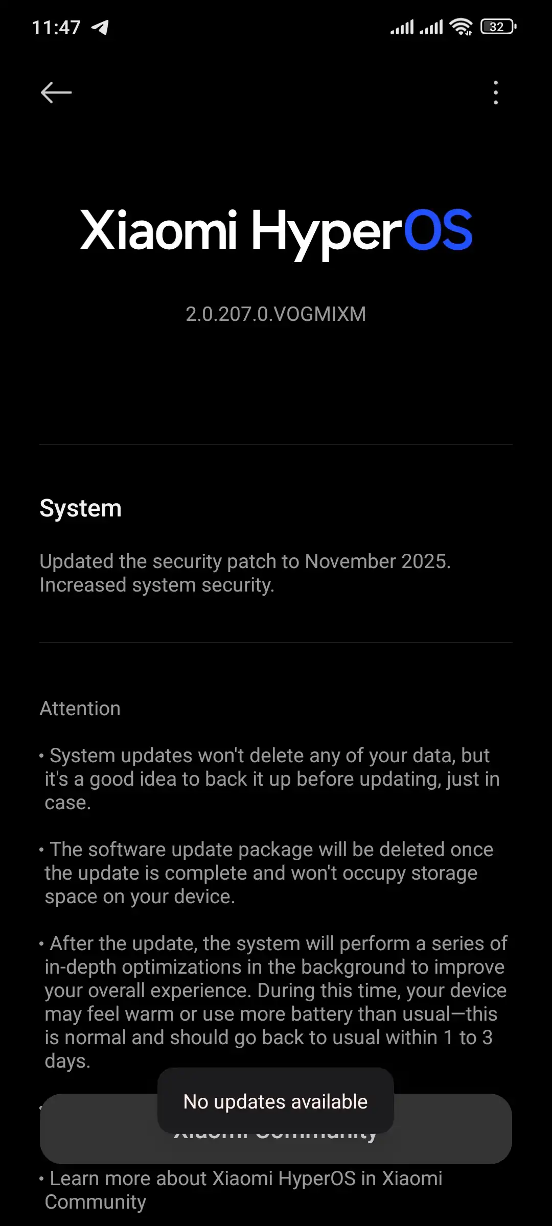 Xiaomi Community